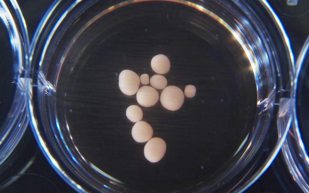 Fairy Controversial: Organoid Intelligence